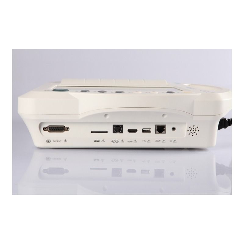 安い金属ECGマシン 12チャネルリードECGマシン ポータブル電動心電図ECGマシン