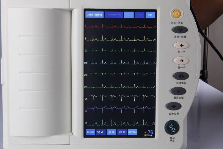 人間用心電図検査機 心臓検査 循環器科 12チャンネル心電図検査機 EKG 心電図検査装置 ECG