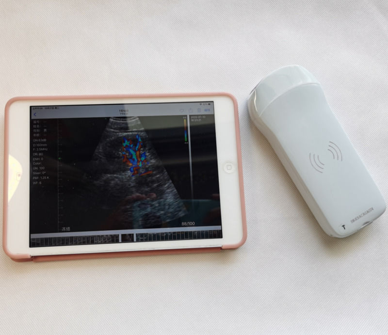 Usg New Look 3d Image GYN Image ラップトップ OB Gyn 胎児超音波機器 高品質のカラードップラー