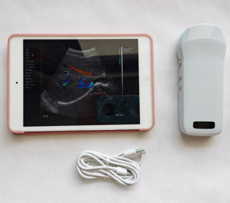 Usg New Look 3d Image GYN Image ラップトップ OB Gyn 胎児超音波機器 高品質のカラードップラー