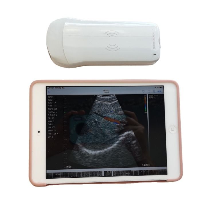 高品質のGYN ポータブル獣医 快速配達 3D診断 医療 馬 牛用超音波機器