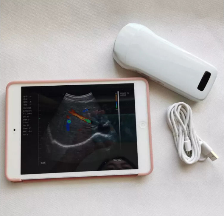 婦人科超音波検査機器 ワイヤレスポータブル臨床プローブ 分析機器 モバイル超音波診断装置
