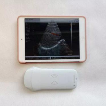 婦人科超音波検査機器 ワイヤレスポータブル臨床プローブ 分析機器 モバイル超音波診断装置